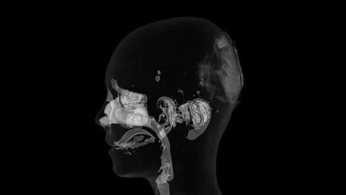 颞骨CT颞骨CT