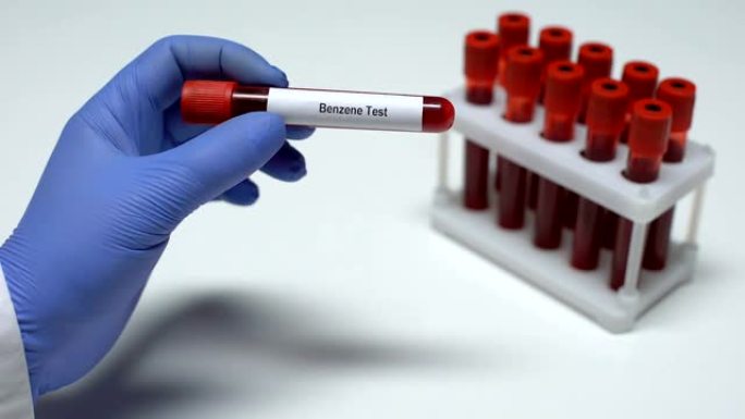 苯测试，医生在试管中显示血样，实验室研究，健康检查