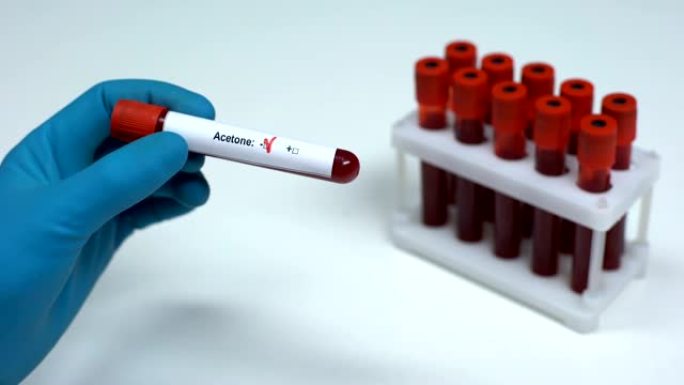 丙酮测试阴性，医生显示血样，实验室研究健康检查