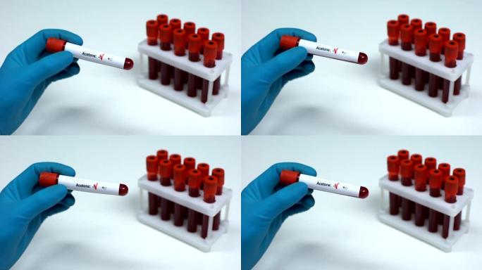 丙酮测试阴性，医生显示血样，实验室研究健康检查