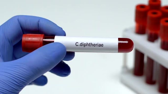 C.diaphtheriae，医生在试管中保存血液样本特写，健康检查