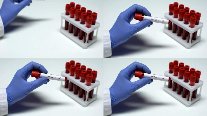 HIV检测阳性，医生显示血液样本，实验室研究，健康检查