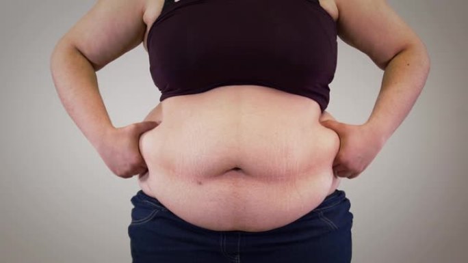 无法辨认的高加索女人肚子的特写。肥胖的成年妇女在肚子上晃动脂肪。超重，肥胖，不健康的生活方式。