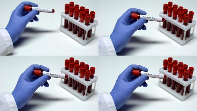 阴性有毒金属测试，医生在试管中显示血样，实验室研究