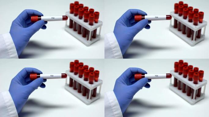 PSA测试，医生在试管中显示血样，实验室研究，健康检查
