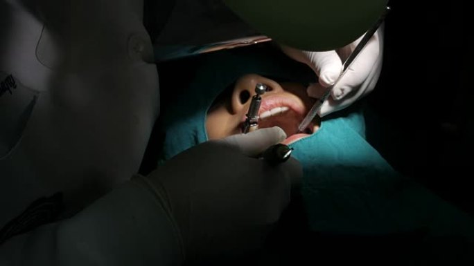 牙医治疗牙齿女人龋齿虫牙矫正洗牙蛀牙补牙