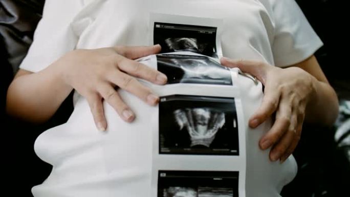 亚洲孕妇显示婴儿的超声图像