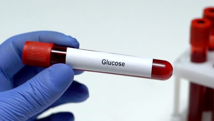 葡萄糖，实验室工作人员在试管中保存血液样本特写，健康检查