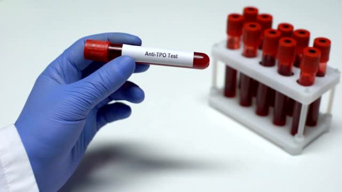 抗TPO测试，医生在试管中显示血样，实验室研究，健康检查