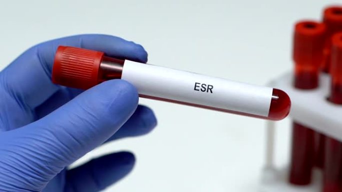 ESR，实验室工作人员在试管中保存血液样本特写，健康检查