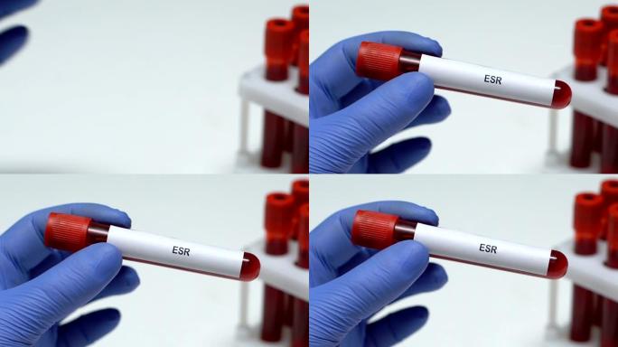 ESR，实验室工作人员在试管中保存血液样本特写，健康检查