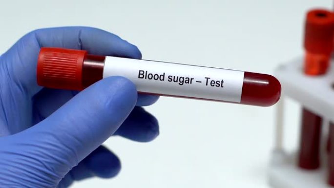 血糖-测试，医生在试管中保存血液样本特写，健康检查