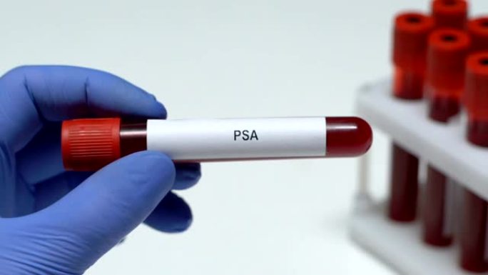 PSA，实验室工作人员在试管中保存血液样本特写，健康检查