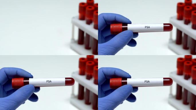 PSA，实验室工作人员在试管中保存血液样本特写，健康检查