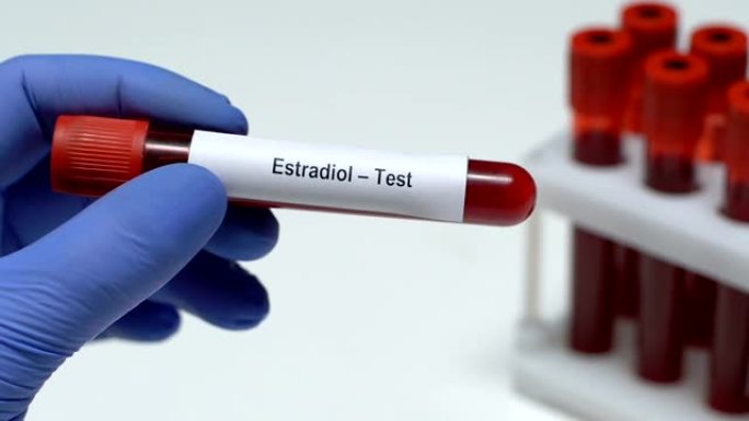 雌二醇-测试，医生在试管中保存血液样本特写，健康检查