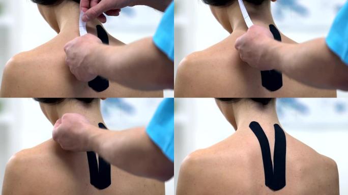 医生在女性上背部使用Y形胶带，减轻肌肉张力