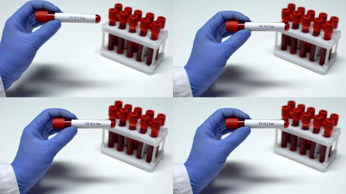 CA 15-3，医生在试管中显示血液样本，实验室研究，健康检查