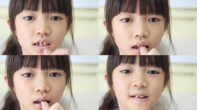 亚洲小女孩扭动一颗松动的牙齿