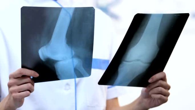 女性创伤学家比较x射线与骨折和健康的骨骼，恢复