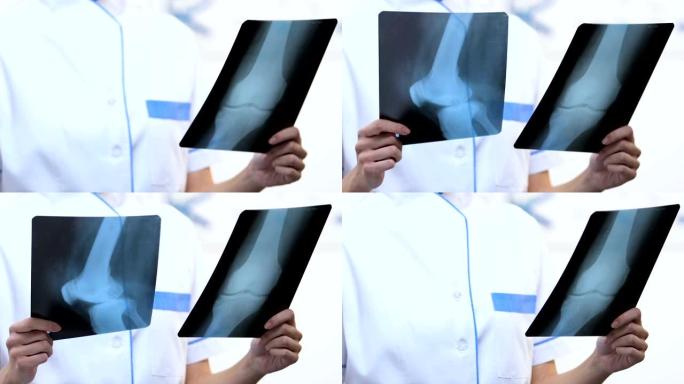 女性创伤学家比较x射线与骨折和健康的骨骼，恢复