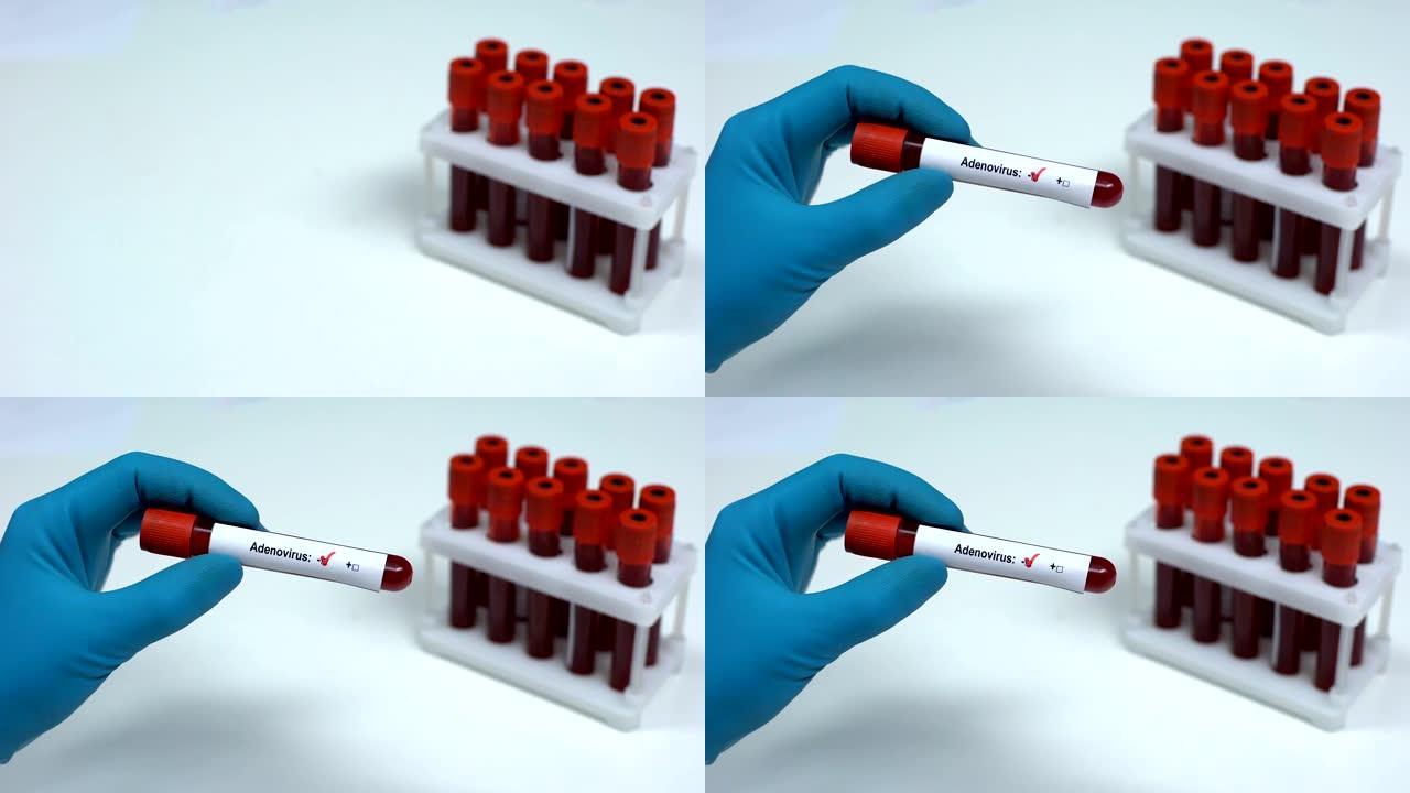 阴性腺病毒，医生显示血样，实验室研究，医疗保健