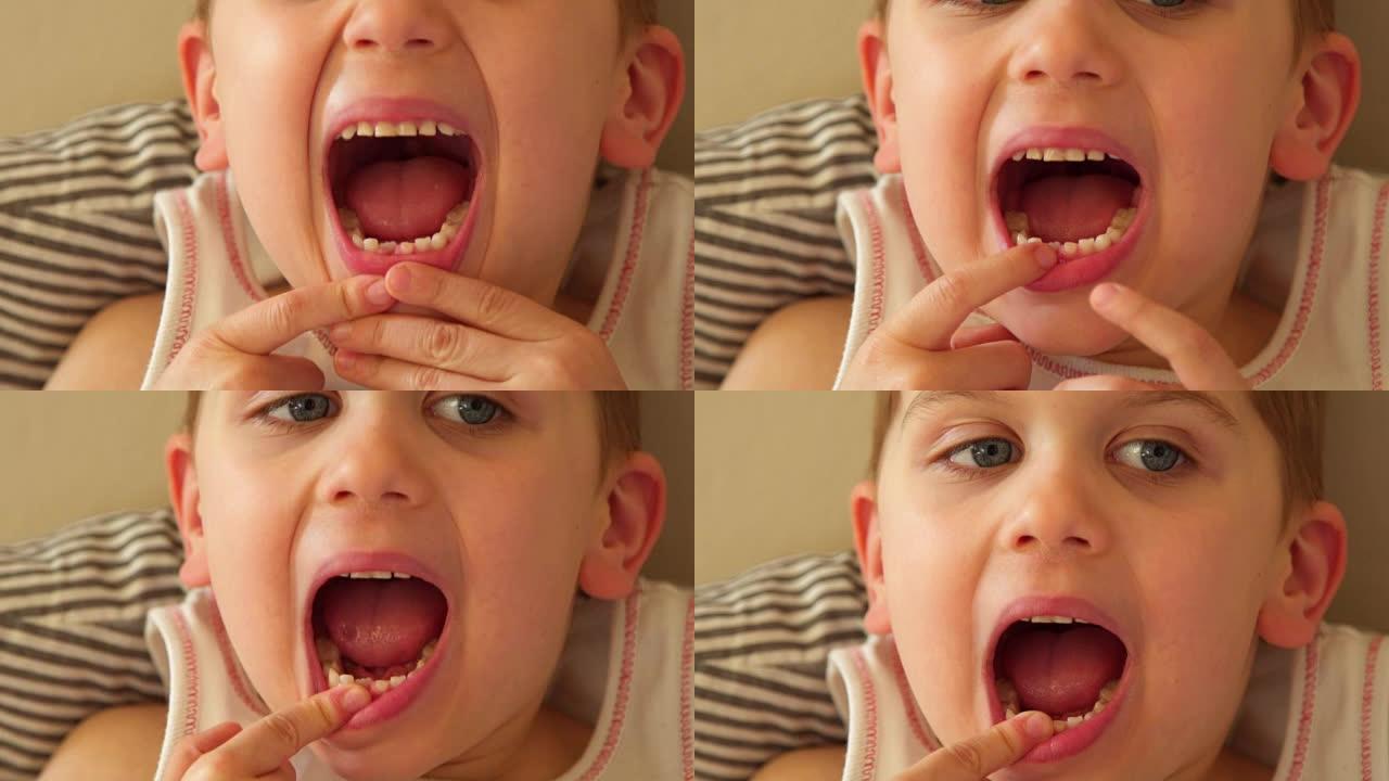 小男孩失去了他的第一颗乳牙