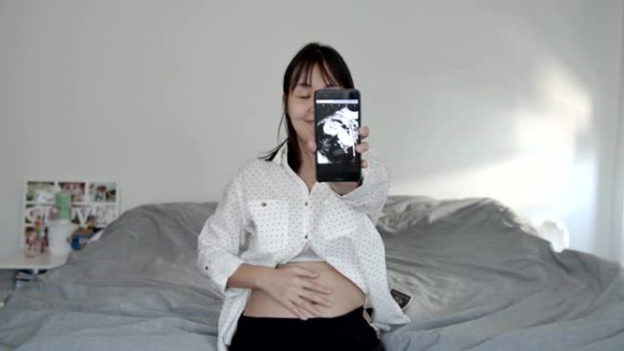 孕妇在智能手机上显示3D超声视频