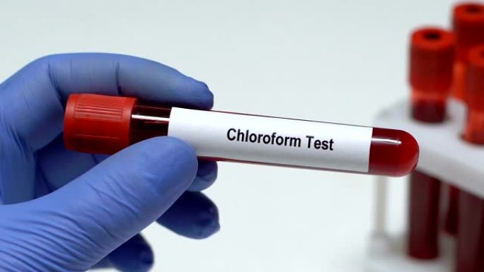 氯仿试验，医生在试管中保存血液样本特写，健康检查