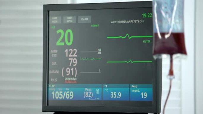 回转室心电图监护仪的心率降至零，输血