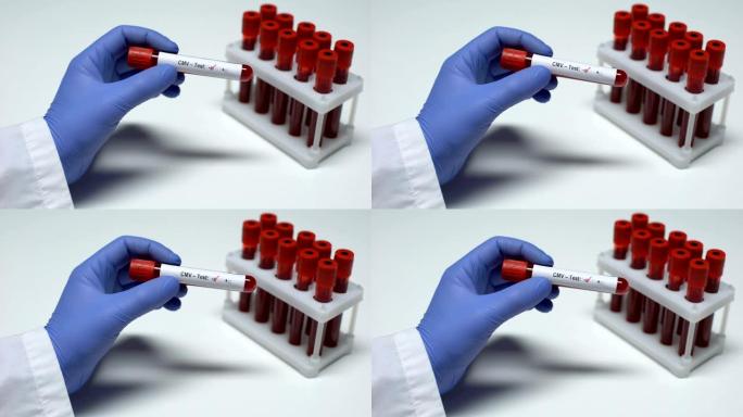 CMV测试阴性，医生显示血样，实验室研究，健康检查