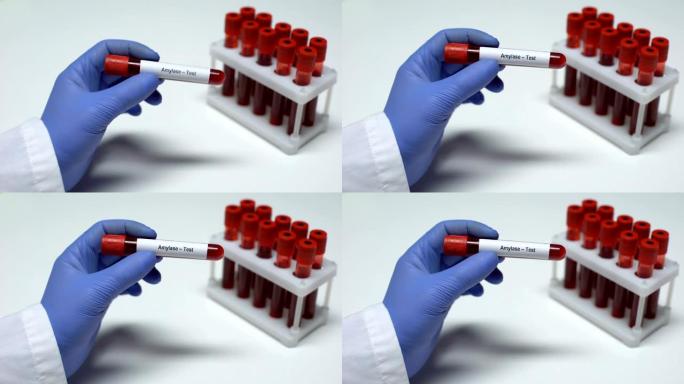 淀粉酶测试，医生在试管中显示血样，实验室研究，健康检查