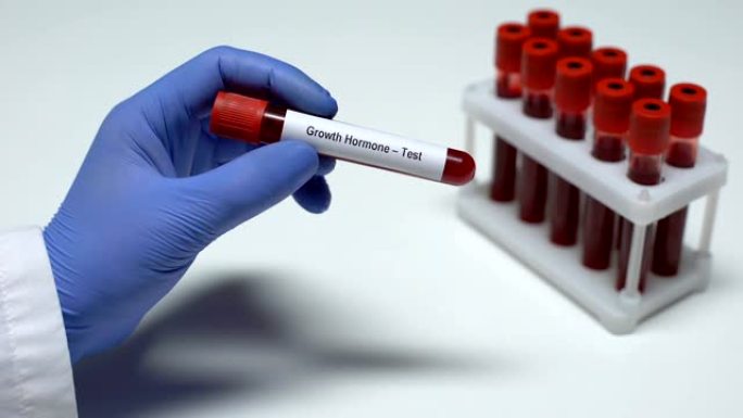生长激素，医生在试管中显示血液样本，实验室研究，健康检查