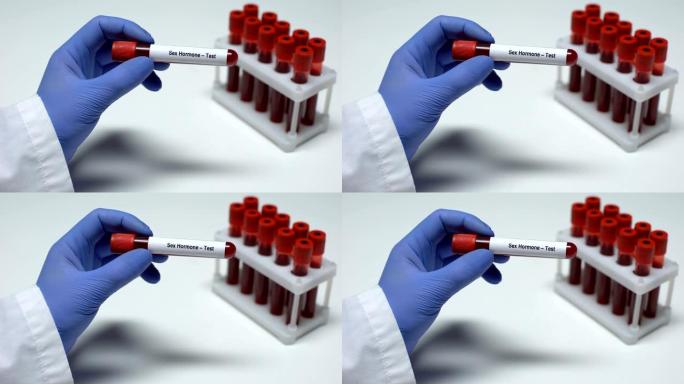 性激素，医生在试管中显示血样，实验室研究，健康检查