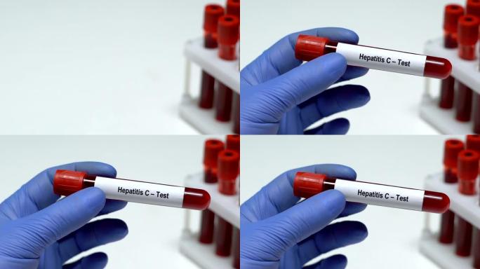 丙型肝炎-测试，医生在试管中保存血液样本特写，健康检查