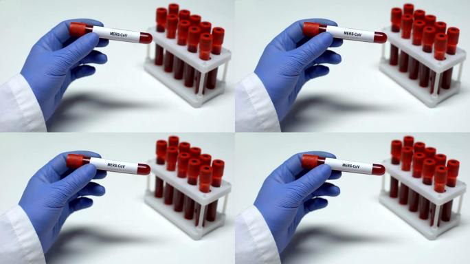 mers冠状病毒，医生在试管中展示血液样本，实验室研究，健康检查