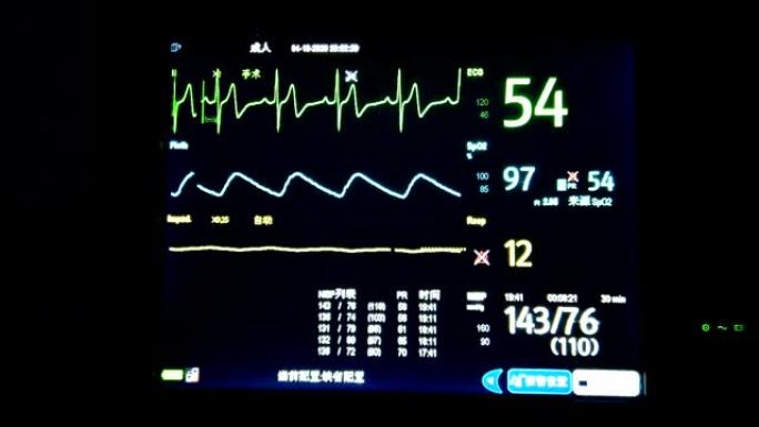 心电监护仪