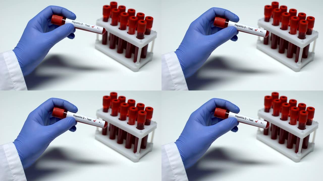 丁型肝炎测试阴性，医生在试管中显示血样，实验室研究