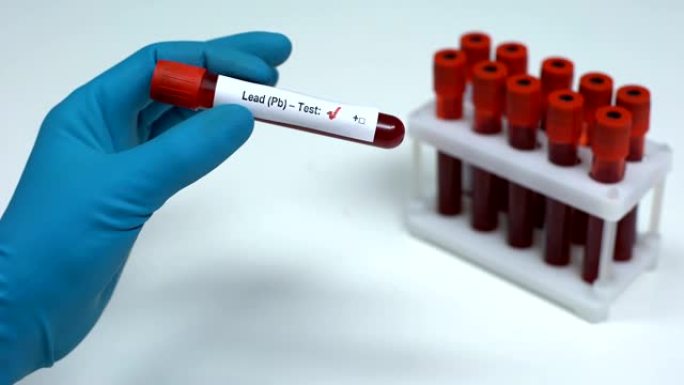 铅 (pb) 阴性测试，医生显示血液样本，实验室研究，医疗保健