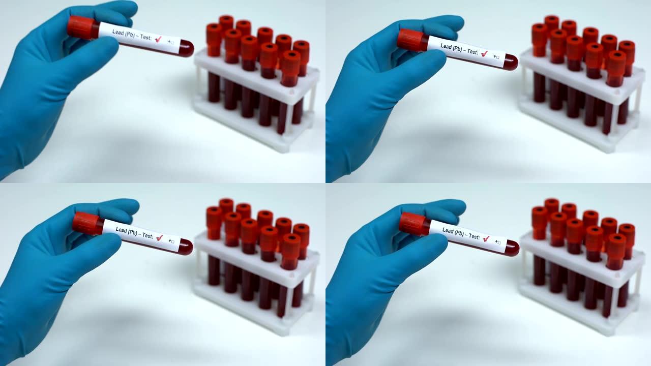 铅 (pb) 阴性测试，医生显示血液样本，实验室研究，医疗保健