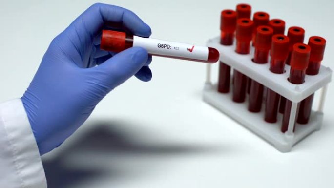 G6PD检测阳性，医生显示血样，实验室研究，健康检查