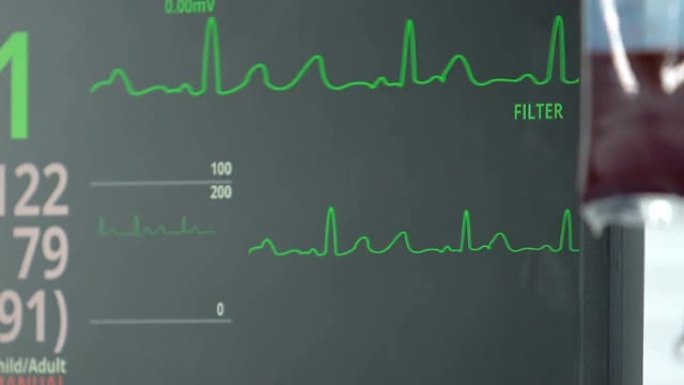 生命体征监视器显示听力，输血，病情稳定
