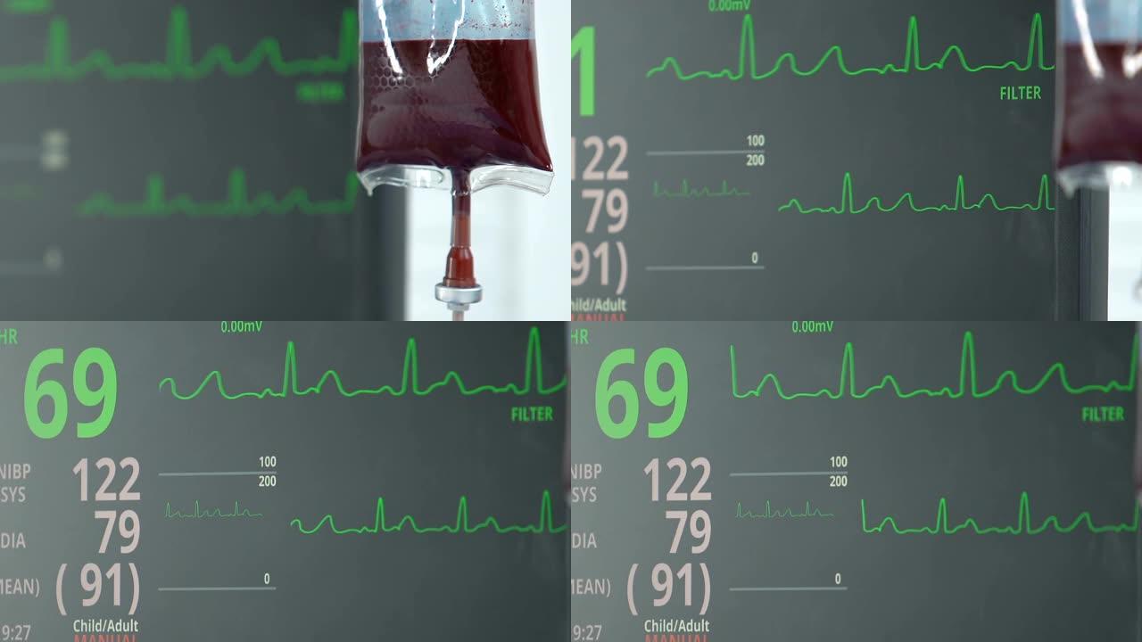 生命体征监视器显示听力，输血，病情稳定