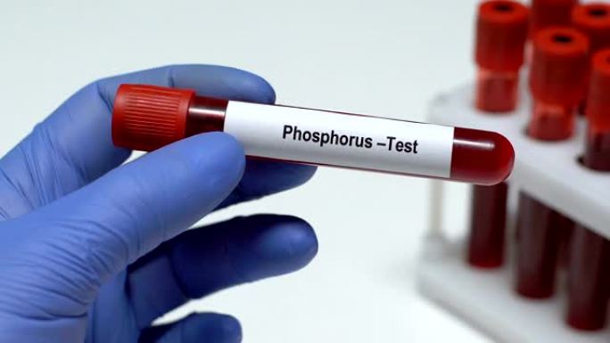 磷-测试，医生在试管中保存血液样本特写，健康检查