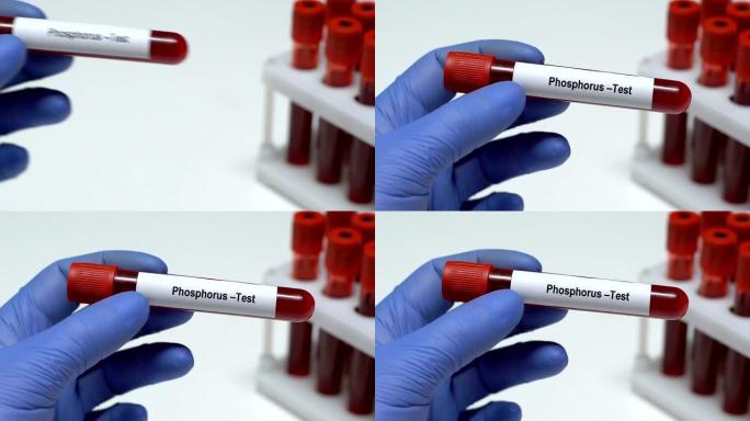 磷-测试，医生在试管中保存血液样本特写，健康检查
