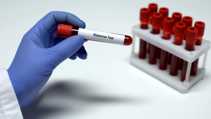 轮状病毒测试，医生在试管中显示血液样本，实验室研究，健康检查