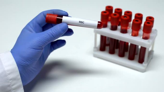 WBC白细胞，医生在试管中显示血液样本，实验室研究，健康检查
