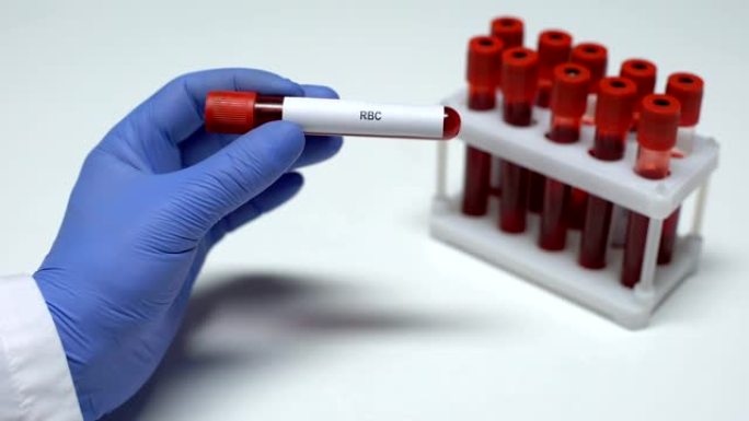 RBC测试，医生在试管中显示血液样本，实验室研究，健康检查