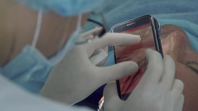 皮肤科医生在手机上制作胎记的宏观照片