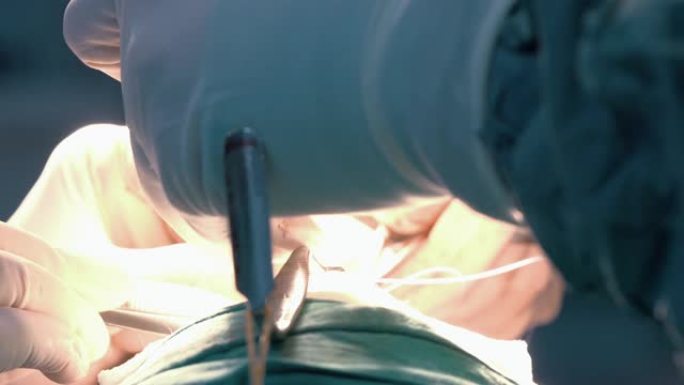 外科医生在隆鼻手术中缝合的特写