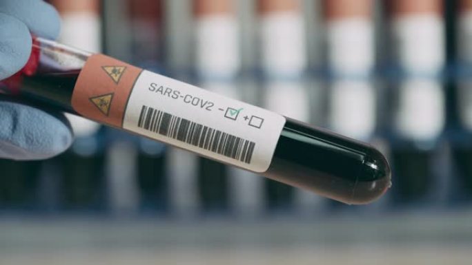 sars-cov-2检测结果阴性，研究者持血样，治疗